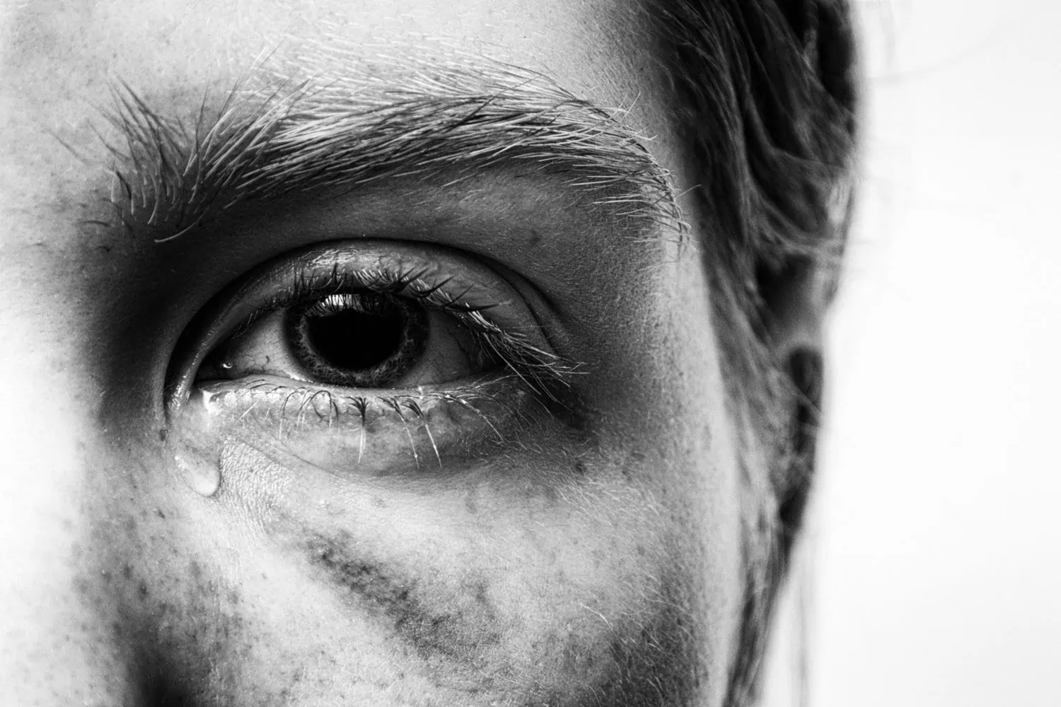 Woman who experience domestic abuse with black eye, not feeling safe after her trauma